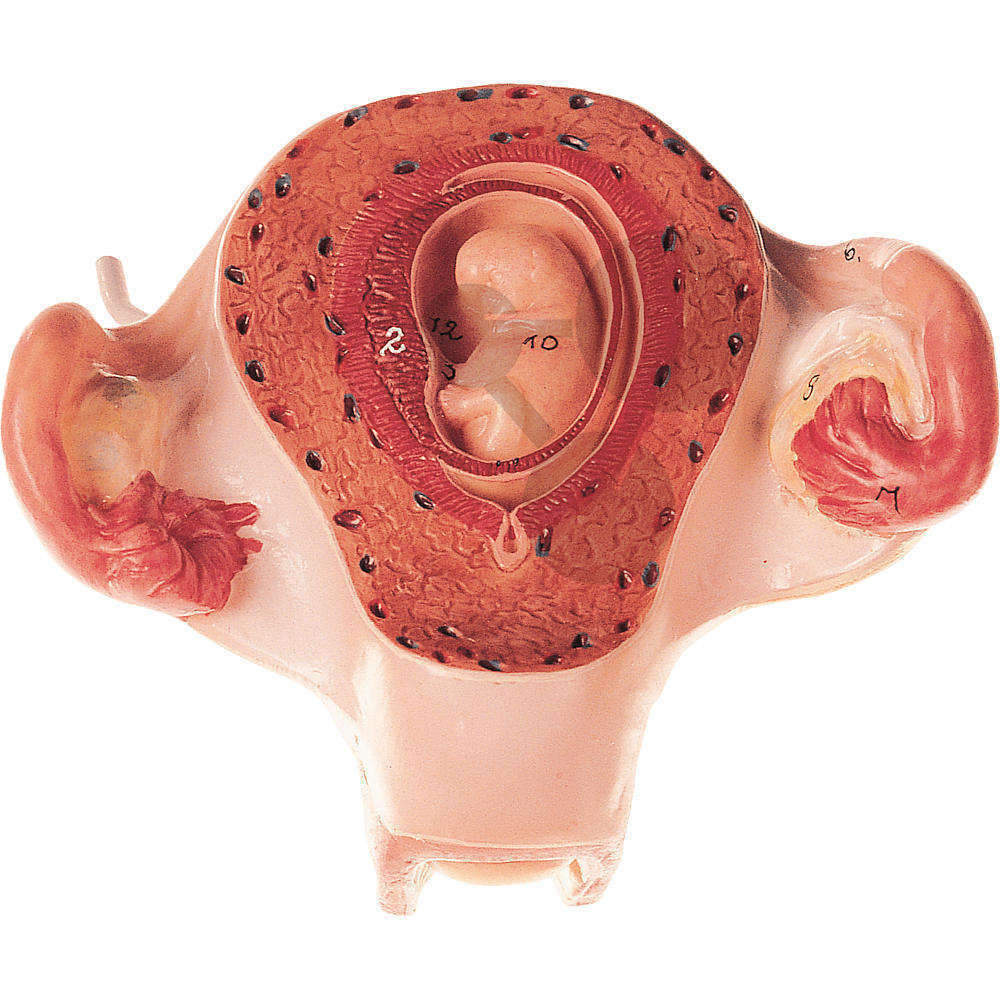 Utérus avec embryon dans le 2. mois