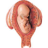Utérus avec foetus dans le 5. mois