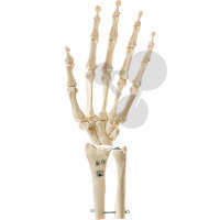 Squelette de la main avec debut du cubitus et du radius