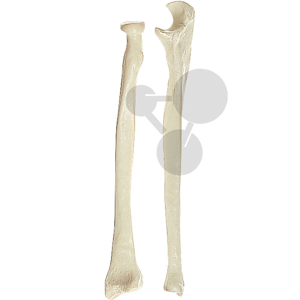 Unterarmknochen (Ulna et Radius) SOMSO®-Modell