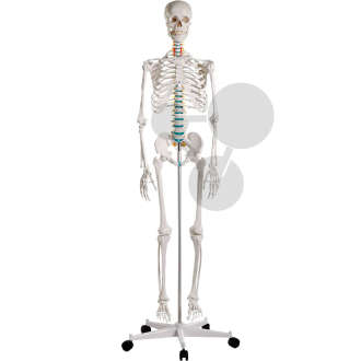Homo-Skelett mit Bandscheibenvorfall Premium