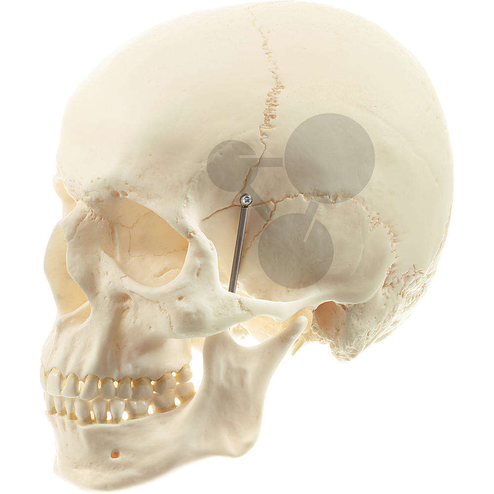 Crâne artificiel