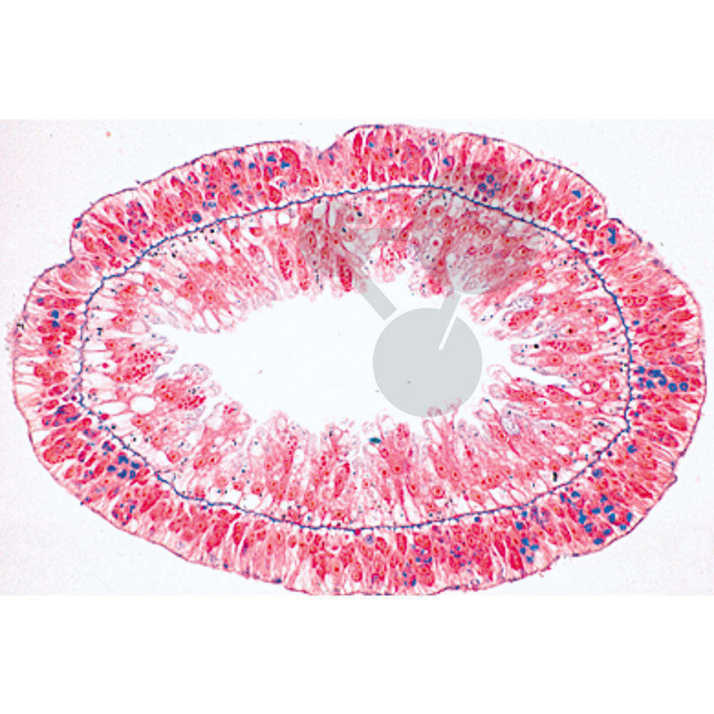 Prép. Micro. Hydra, ecto- et endoderme, cnidoblastes
