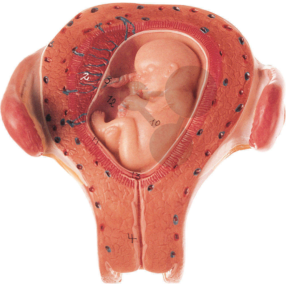 Utérus avec embryon au 3° mois