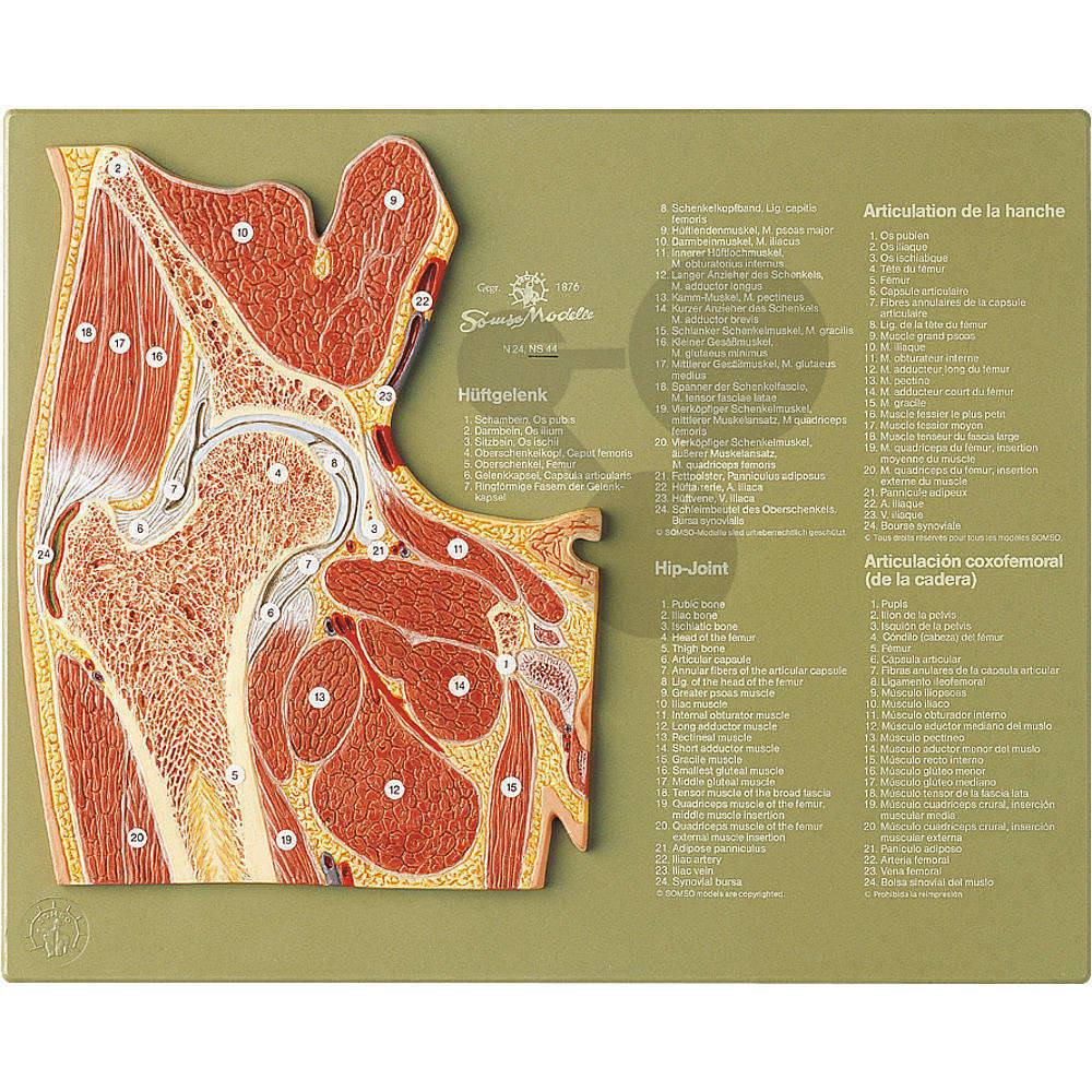 Gelenkschnitt "Hüftgelenk" SOMSO®-Modell