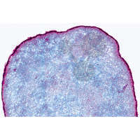Claviceps purpurea, Mutterkorn, Sklerotium quer
